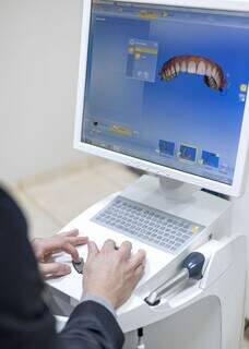 Tecnologia permite prever resultado das lentes e ter sorriso sem exageros