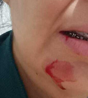 Acumulando den&uacute;ncias de agress&atilde;o, servidor aparece em campanha do Dia da Mulher