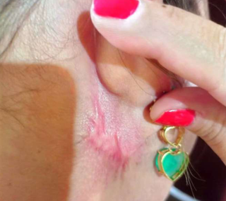 Cl&iacute;nica e dentistas s&atilde;o condenadas ap&oacute;s cirurgias est&eacute;ticas deformarem rosto