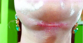 Cl&iacute;nica e dentistas s&atilde;o condenadas ap&oacute;s cirurgias est&eacute;ticas deformarem rosto