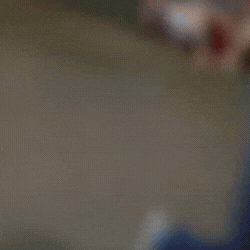 Mulher tem perna arrancada ap&oacute;s ser atropelada e motorista foge