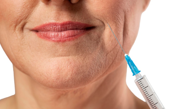 Anvisa alerta para riscos graves do uso indevido de preenchedores est&eacute;ticos