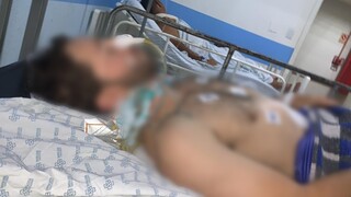 Rapaz foi baleado a 100 metros de onde irm&atilde; foi espancada at&eacute; a morte h&aacute; 1 ano