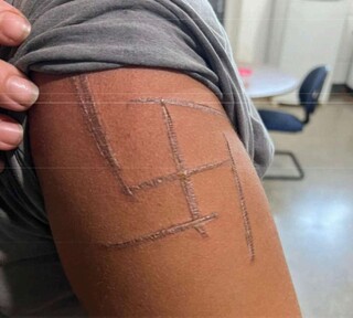 &ldquo;Achei que iam me matar&rdquo;, diz mulher trans espancada e marcada com su&aacute;stica