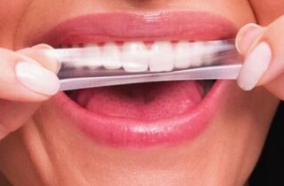 Anvisa manda recolher fitas de clareamento que viralizaram nas redes sociais