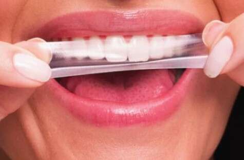 Anvisa manda recolher fitas de clareamento que viralizaram nas redes sociais