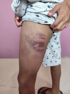 Menino autista &eacute; agredido por colega de sala e os pais dele na sa&iacute;da de aula