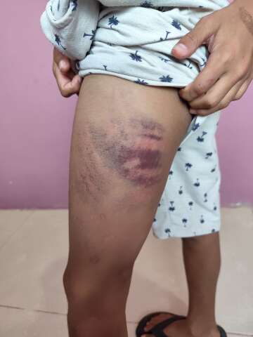 Menino autista &eacute; agredido por colega e pais na sa&iacute;da de aula