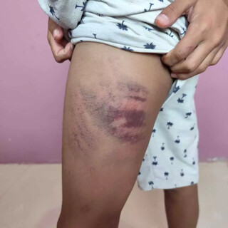 Menino autista &eacute; agredido por colega e pais na sa&iacute;da de aula