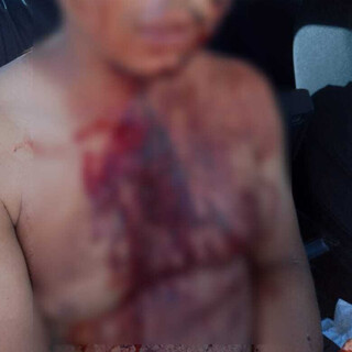 Serralheiro tem pesco&ccedil;o cortado ap&oacute;s ter casa invadida e ser rendido por ladr&otilde;es