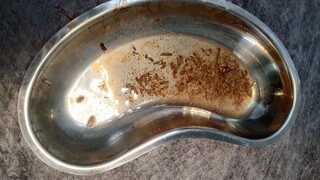 Crueldade choca e protetora pede ajuda para salvar shih tzu cego e com larvas Crueldade choca e protetora pede ajuda para salvar shih tzu cego e com larvas