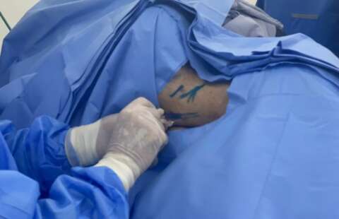 Na esperan&ccedil;a de voltar a andar, mais 2 pacientes recebem polilaminina na Capital