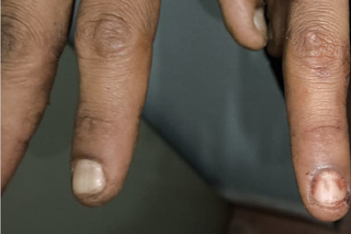 Antes de assassinar a tia, homem preparou macarr&atilde;o para os dois