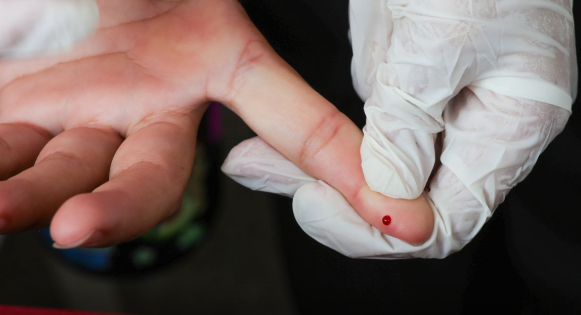 SUS passa a oferecer teste r&aacute;pido para diagn&oacute;stico da dengue em todo o Pa&iacute;s