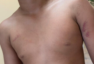 &ldquo;Corretivo&rdquo; em projeto social deixa adolescente ferido e fam&iacute;lia vai &agrave; pol&iacute;cia