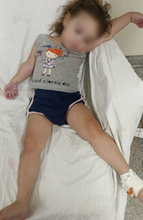 Falta de medicamento na Casa da Sa&uacute;de afeta crian&ccedil;a com doen&ccedil;a nos rins