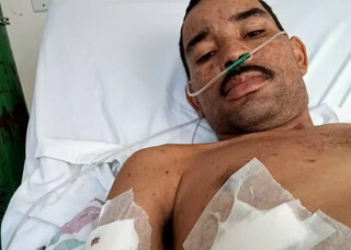 Ap&oacute;s diagn&oacute;stico de hansen&iacute;ase, frutaria vira salva&ccedil;&atilde;o de fam&iacute;lia