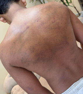 &ldquo;Corretivo&rdquo; em projeto social deixa adolescente ferido e fam&iacute;lia vai &agrave; pol&iacute;cia