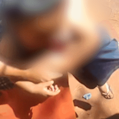 Beb&ecirc; &eacute; atingido por golpe de fac&atilde;o na cabe&ccedil;a em Dourados