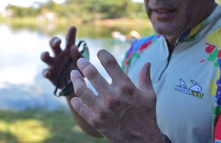 Anderson Guedes relembra luta mortal contra onça há 20 anos