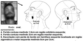 Laudo refor&ccedil;a vers&atilde;o da fam&iacute;lia sobre jovem morto pela PM