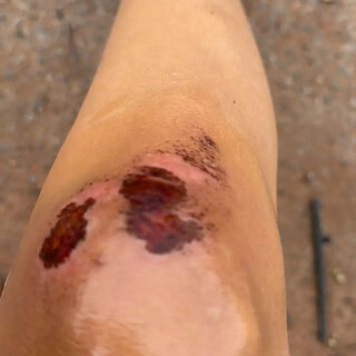 &ldquo;Mesmo dopada, sa&iacute; na rua pedindo socorro&rdquo;, diz mulher perseguida pelo ex