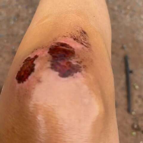 &ldquo;Mesmo dopada, eu sa&iacute; na rua pedindo socorro&rdquo;, diz mulher perseguida pelo ex