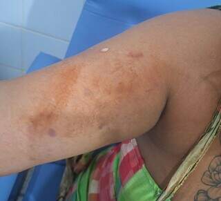 Ap&oacute;s 3 meses de relacionamento, homem espanca e tenta matar mulher a facadas