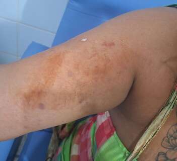 Ap&oacute;s 3 meses de relacionamento, homem espanca e tenta matar mulher a facadas