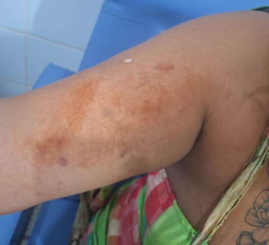 Ap&oacute;s 3 meses de relacionamento, homem espanca e tenta matar mulher a facadas