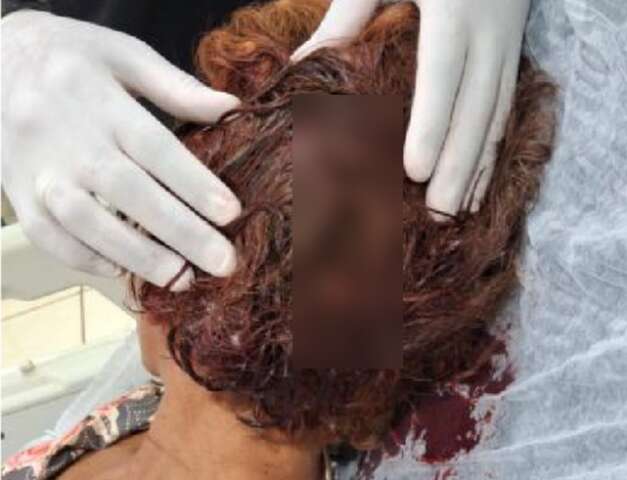 "Para servir de exemplo": traficantes torturam mulher por d&iacute;vida de R$ 50
