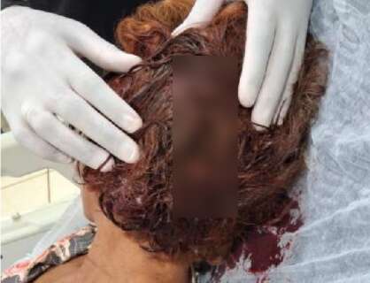 "Para servir de exemplo": traficantes torturam mulher por d&iacute;vida de R$ 50