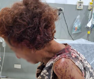 "Para servir de exemplo": traficantes torturam mulher por d&iacute;vida de R$ 50