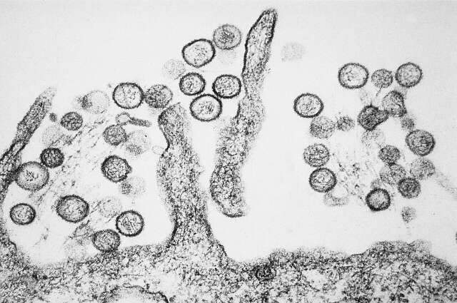 Infectologista da Capital detalha sintomas e preven&ccedil;&atilde;o &agrave; hantavirose