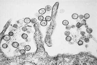 Infectologista da Capital detalha sintomas e prevenção à hantavirose Infectologista da Capital detalha sintomas e prevenção à hantavirose