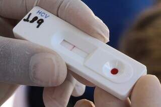 Após tratamento, pacientes com hepatite C terão cura monitorada Após tratamento, pacientes com hepatite C terão cura monitorada