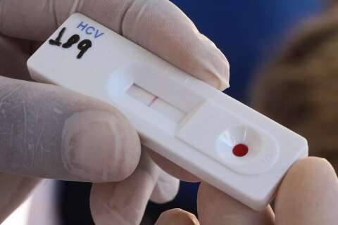 Ap&oacute;s tratamento, pacientes com hepatite C ter&atilde;o cura monitorada