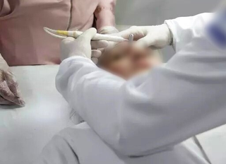Conselho de Medicina libera uso de fenol mesmo após proibição sanitária Conselho de Medicina libera uso de fenol mesmo após proibição sanitária