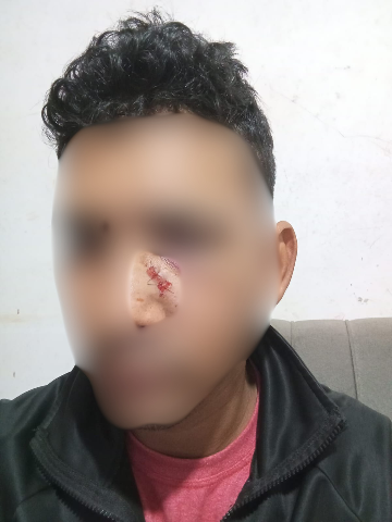 Horas ap&oacute;s crian&ccedil;a ferida, trabalhador acorda baleado no rosto dentro de casa