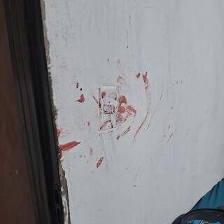 Horas após criança ferida, trabalhador acorda baleado no rosto dentro de casa Horas após criança ferida, trabalhador acorda baleado no rosto dentro de casa