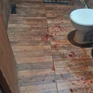 Horas após criança ferida, trabalhador acorda baleado no rosto dentro de casa Horas após criança ferida, trabalhador acorda baleado no rosto dentro de casa