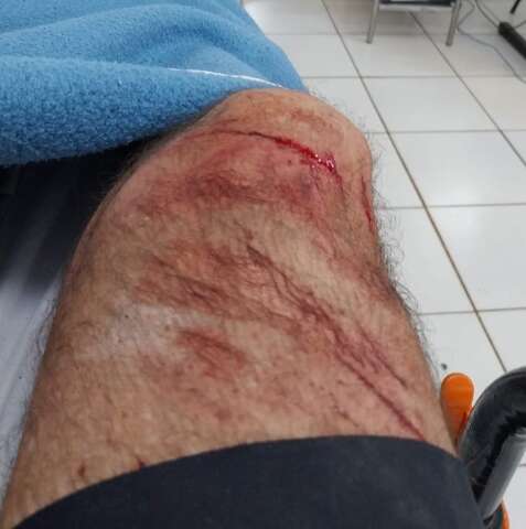 Ciclista cai ao passar por ciclovia bloqueada por passarela elevada 