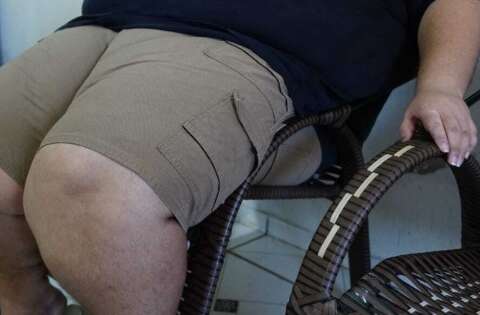 Sesau cria programa para combater obesidade entre servidores da sa&uacute;de
