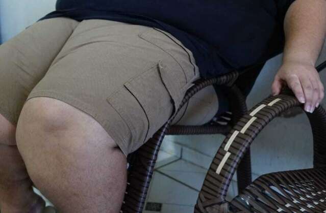 Sesau cria programa para combater obesidade entre servidores da sa&uacute;de