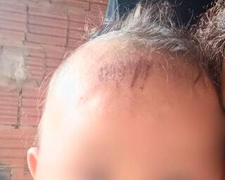 "A lama amorteceu a queda", diz avó de bebê atropelada por bêbado "A lama amorteceu a queda", diz avó de bebê atropelada por bêbado