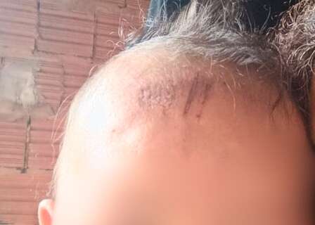 "A lama amorteceu a queda", diz av&oacute; de beb&ecirc; atropelada nas Moreninhas