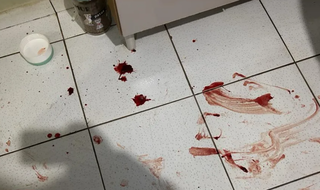 Frentista é baleado por dupla de capacete e foge pulando muros Frentista é baleado por dupla de capacete e foge pulando muros