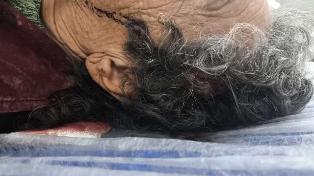 Pitbull invade casa, ataca idosa de 75 anos e tutor PM vai parar na delegacia