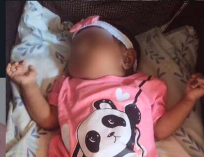 Beb&ecirc; de tr&ecirc;s meses morre uma semana ap&oacute;s ser internada com fraturas nas costelas
