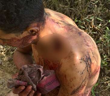 Nu e gravemente ferido, homem &eacute; resgatado pela Pol&iacute;cia Militar 
